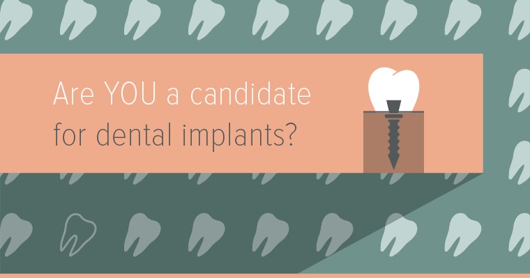 Seattle WA Dentist | Are Dental Implants the Right Solution for Your Missing Teeth?