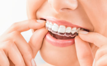 Why Is Invisalign The Right Choice for You