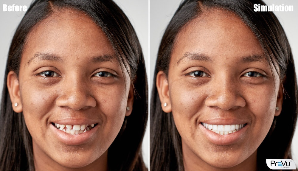Before and after photos of a female patient